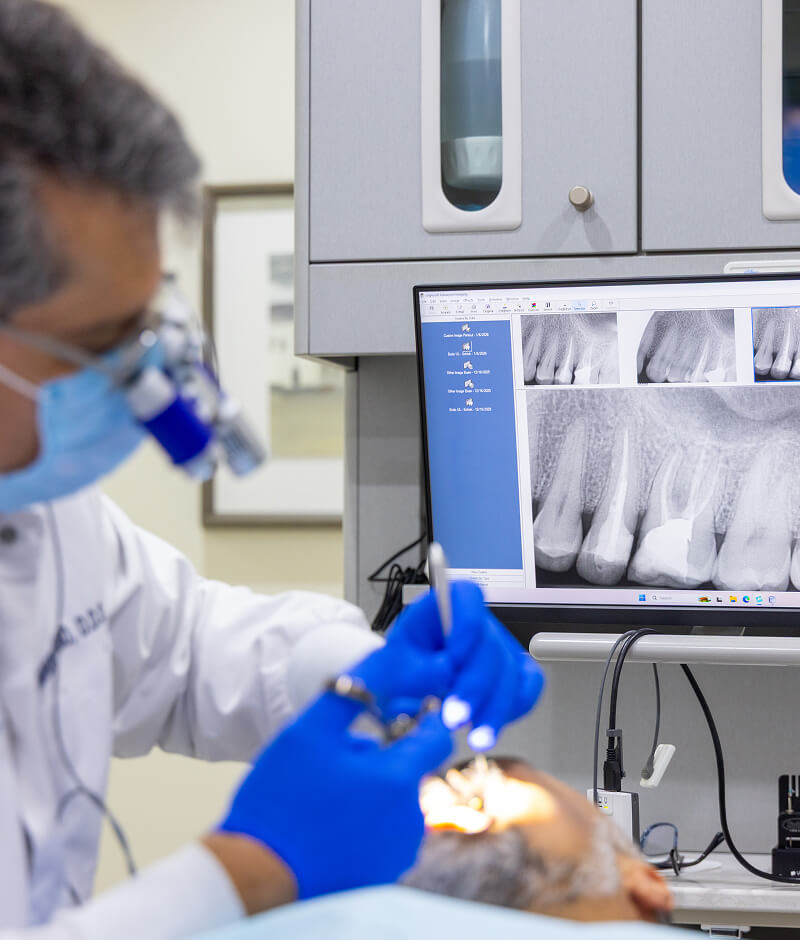 root canal therapy Huntington Beach, CA