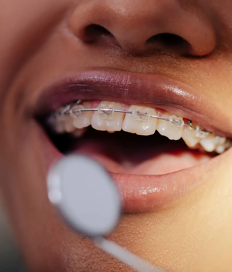 orthodontics Huntington Beach, CA