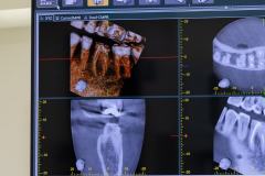 gallery_6_dentist_laguna_beach_ca